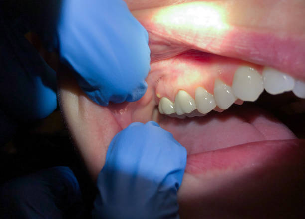 Best Tooth Pain Emergency Relief  in Bellevle, IL